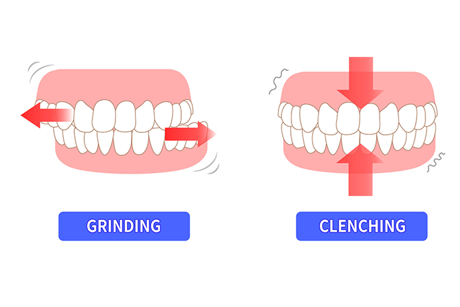 Grinding teeth photo