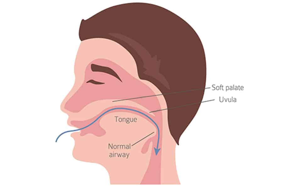 Mouth breathing photo